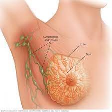 Breast Cancer Specialist in Ranchi